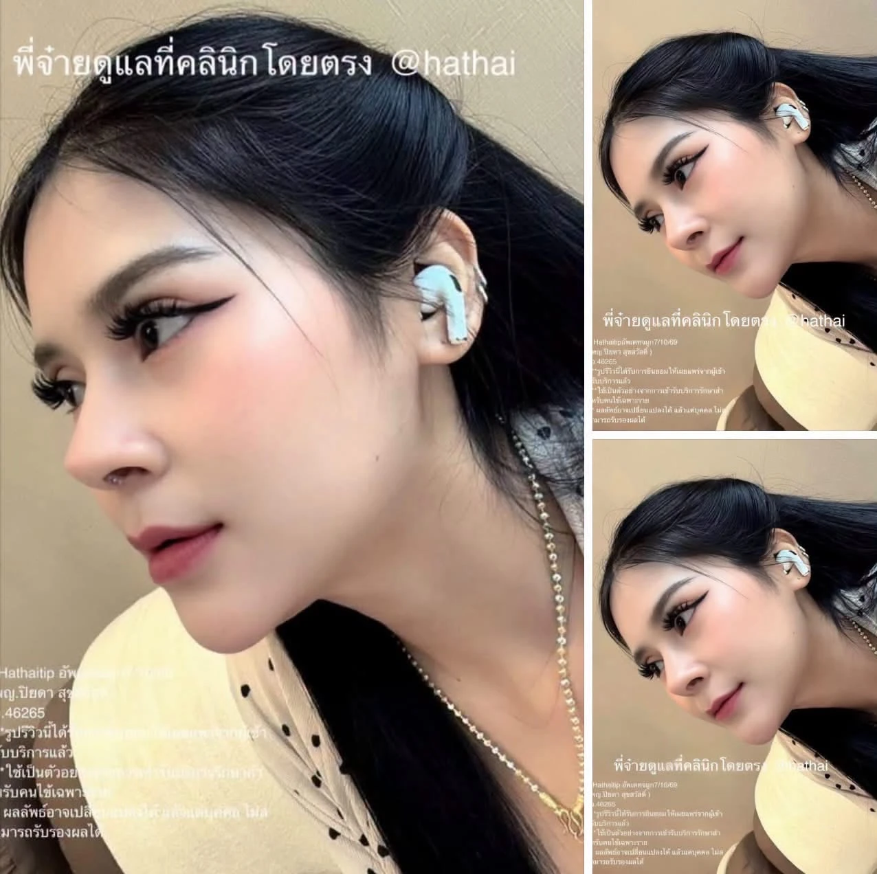 ภาพตัวอย่างเคสจมูกจากสื่อที่เพจให้มา